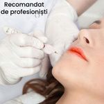 Ingrijire personala si Cosmetice - Aparate & accesorii ingrijire personala - Aparate cosmetice - Aparate intretinere si ingrijire corporala - Aparat Fibroblast Plasma Pen, GlowforHome, pentru indepartarea Tatuajelor, Cicatricilor, Alunitelor, Pistruilor, Alb - Infinity.ro
