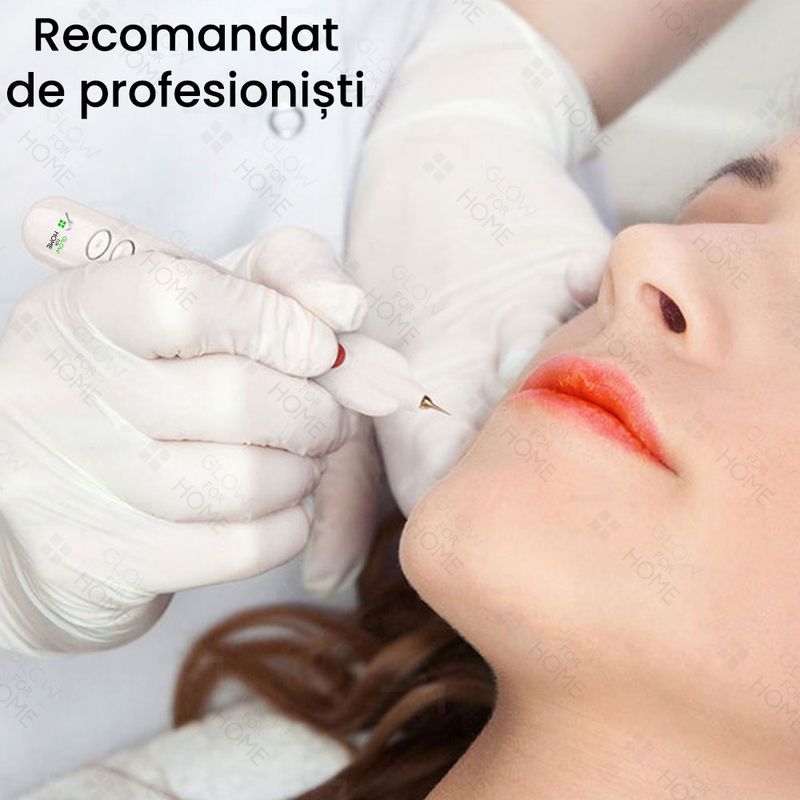 Ingrijire personala si Cosmetice - Aparate & accesorii ingrijire personala - Aparate cosmetice - Aparate intretinere si ingrijire corporala - Aparat Fibroblast Plasma Pen, GlowforHome, pentru indepartarea Tatuajelor, Cicatricilor, Alunitelor, Pistruilor, Alb - Infinity.ro