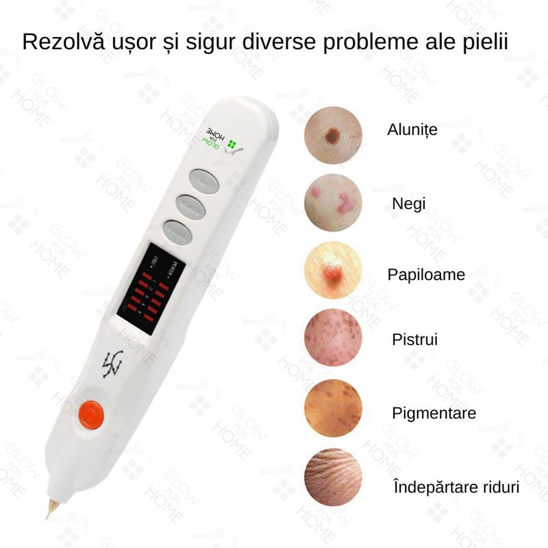 Ingrijire personala si Cosmetice - Aparate & accesorii ingrijire personala - Aparate cosmetice - Aparate intretinere si ingrijire corporala - Aparat Fibroblast Plasma Pen, GlowforHome, pentru indepartarea Tatuajelor, Cicatricilor, Alunitelor, Pistruilor, Alb - Infinity.ro