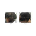 Ingrijire personala si Cosmetice - Sanatate si wellness - Suplimente alimentare - Vitamine si minerale - FOLIGAIN balsam pentru regenerarea parului pentru barbati 2% Trioxidil® (8oz) 236ml - Infinity.ro