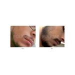 Ingrijire personala si Cosmetice - Sanatate si wellness - Suplimente alimentare - Vitamine si minerale - FOLIGAIN balsam pentru regenerarea parului pentru barbati 2% Trioxidil® (8oz) 236ml - Infinity.ro