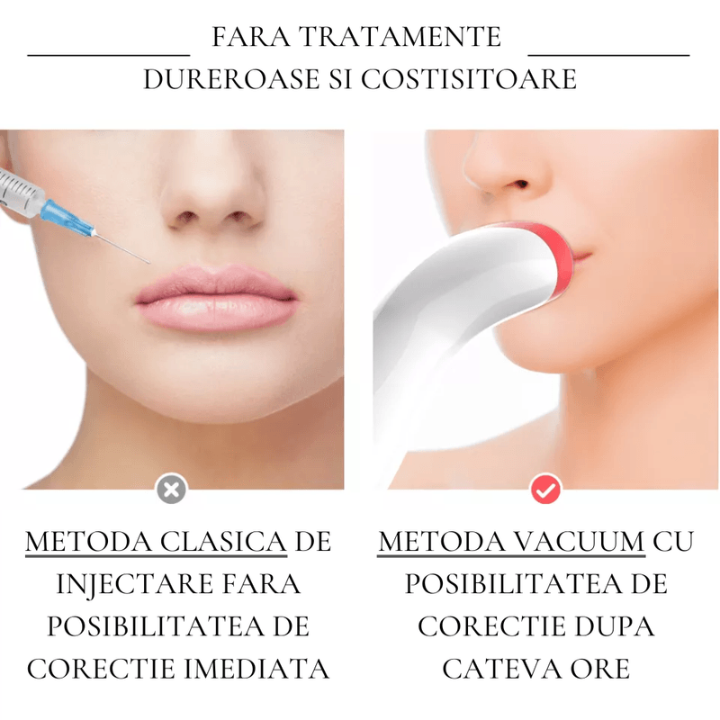 Ingrijire personala si Cosmetice - Aparate & accesorii ingrijire personala - Aparate cosmetice - Aparate intretinere si ingrijire corporala - Aparat pentru Marirea Buzelor, Efect de Lifting si Volumizare Buze Fara Injectare - Infinity.ro