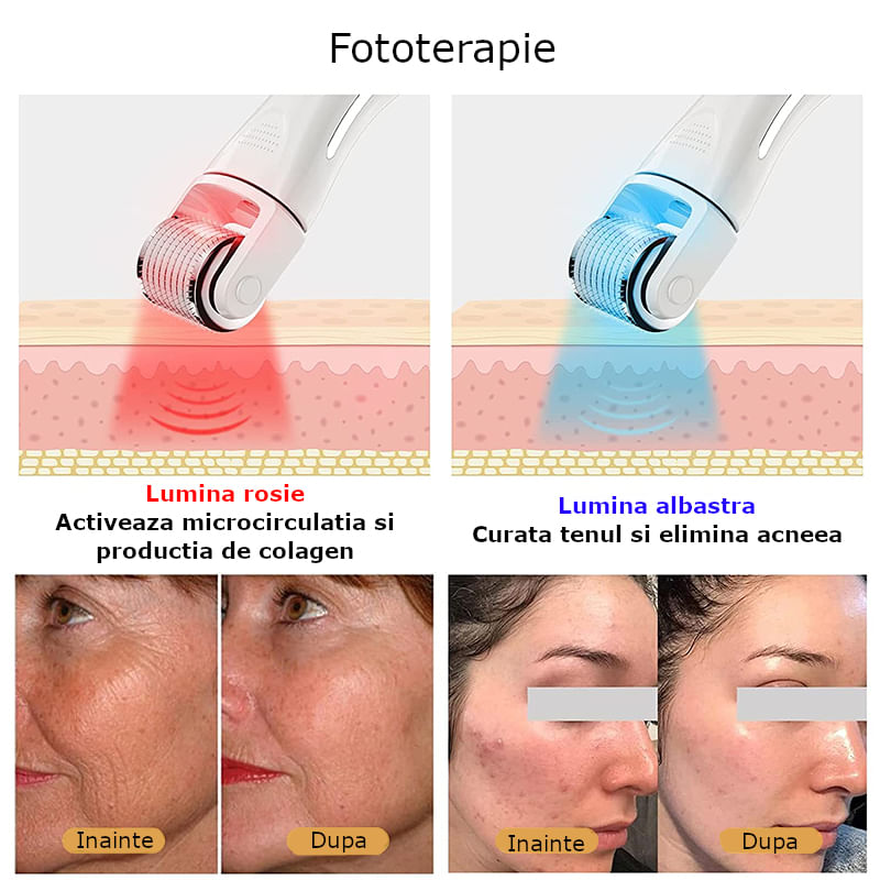 Ingrijire personala si Cosmetice - Aparate & accesorii ingrijire personala - Aparate cosmetice - Aparate intretinere si ingrijire corporala - Rola dermatologica pentru mezoterapie, rejuvenare a pielii, indepartare a ridurilor, curatare a porilor, fototerapie - Infinity.ro