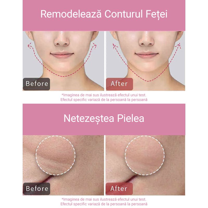 Ingrijire personala si Cosmetice - Aparate & accesorii ingrijire personala - Aparate cosmetice - Aparate intretinere si ingrijire corporala - Aparat pentru subtierea fetei, lifting, vibromasaj, stimuleaza circulatia sangelui, anti-imbatranire, EMS, 400 mAh - Infinity.ro