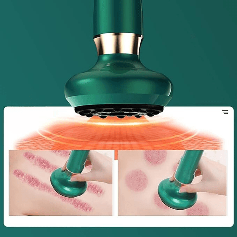 Ingrijire personala si Cosmetice - Sanatate si wellness - Articole wellness - Aparate si dispozitive de masaj - Aparat de Masaj Electric, Ventuza Anticelulita, Medicina Chinezeasca, Bile Magnetice, 12 Niveluri de Aspiratie, USB - Infinity.ro