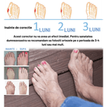 Ingrijire personala si Cosmetice - Sanatate si wellness - Aparate medicale - Suporturi ortopedice si orteze - Set 2 bucati orteze pentru corectarea monturilor, Gadgetry eliminarea - Infinity.ro