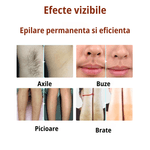 Ingrijire personala si Cosmetice - Aparate & accesorii ingrijire personala - Epilatoare si accesorii - Epilatoare - Epilator IPL Premium MAROVIO®, 999.999 pulsatii, epilare definitiva, senzor piele, 5 viteze, tub lumina quartz Xenon, Alb - Infinity.ro