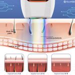 Ingrijire personala si Cosmetice - Aparate & accesorii ingrijire personala - Epilatoare si accesorii - Epilatoare - Epilator IPL NeoHGS, Epilare Definitiva Fara Durere, Tehnologie IPL, 5 Trepte De Intensitate,Senzor Piele, Mod Automat - Infinity.ro
