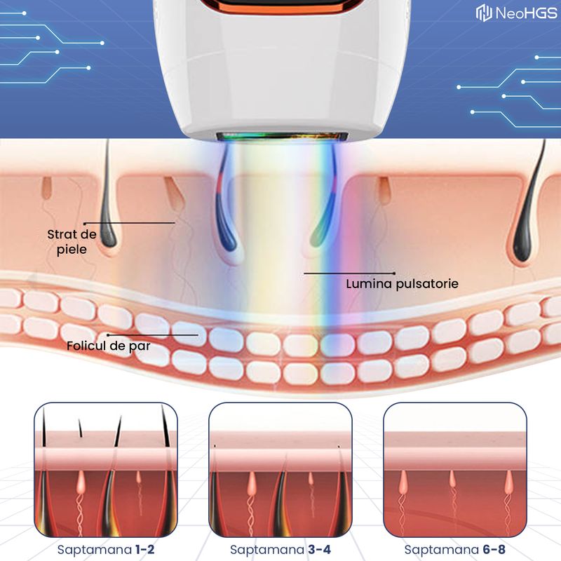 Ingrijire personala si Cosmetice - Aparate & accesorii ingrijire personala - Epilatoare si accesorii - Epilatoare - Epilator IPL NeoHGS, Epilare Definitiva Fara Durere, Tehnologie IPL, 5 Trepte De Intensitate,Senzor Piele, Mod Automat - Infinity.ro