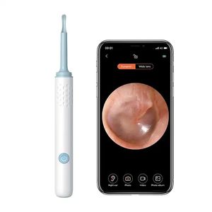 Endoscop smart pentru curatare a urechilor camera 5MP 100 Pixel, Full HD si lumina LED X 6, Wi-fi, accesorii incluse,