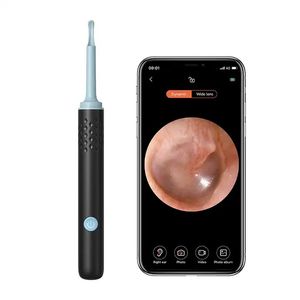 Endoscop smart pentru curatare a urechilor camera 5MP 100 Pixel, Full HD si lumina LED X 6, Wi-fi, accesorii incluse,