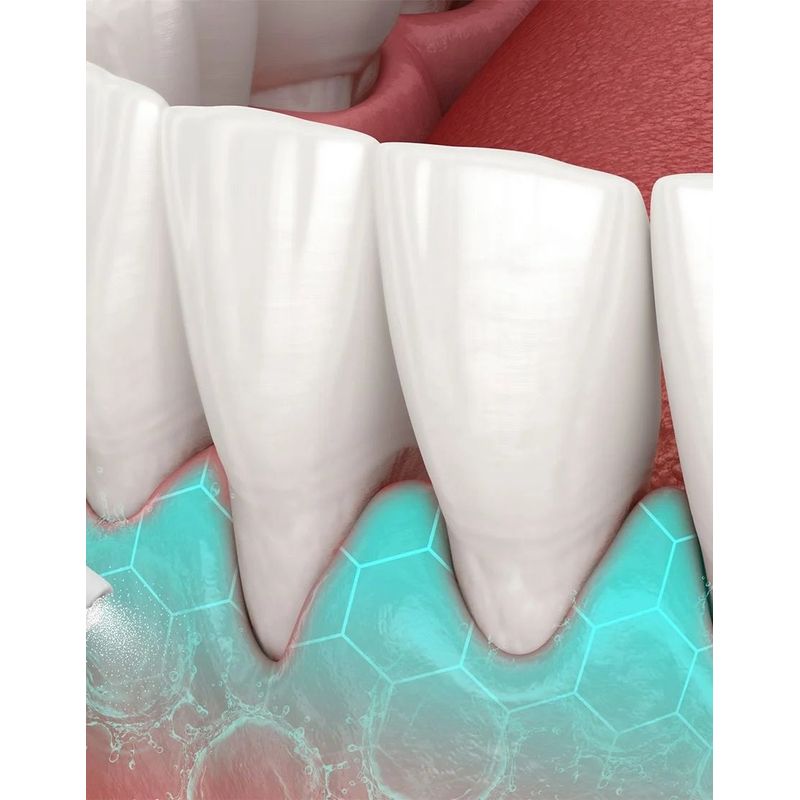 Ingrijire personala si Cosmetice - Igiena dentara - Irigatoare bucale - Irigator oral profesional pentru dus bucal, 3 moduri de curatare, Capacitate 230 ml, Calitate Premium - Infinity.ro