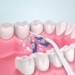 Ingrijire personala si Cosmetice - Igiena dentara - Irigatoare bucale - Irigator oral pentru dus bucal, Profesional, 4 accesorii si 3 moduri curatare, 220mL, Verde - Infinity.ro