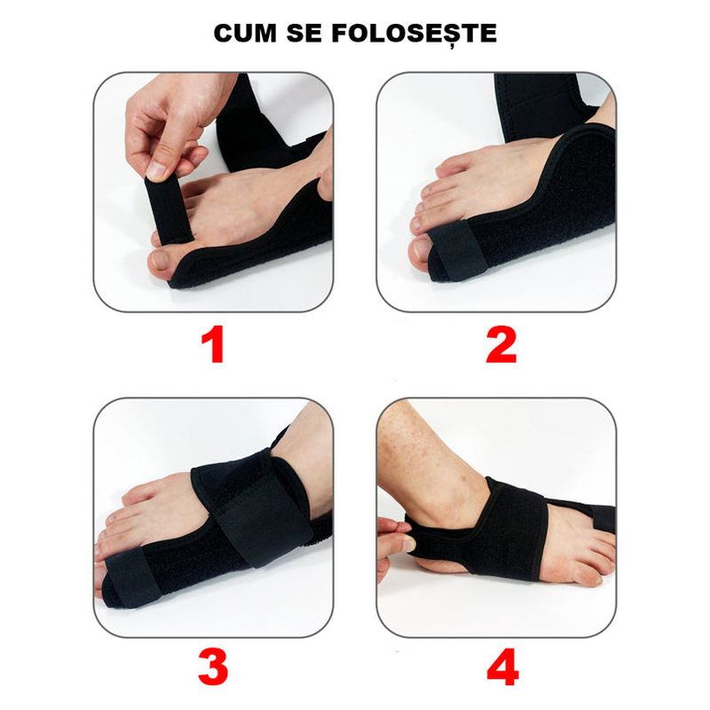 Ingrijire personala si Cosmetice - Sanatate si wellness - Aparate medicale - Suporturi ortopedice si orteze - Set 2 bucati Corector Monturi, Eliminarea Inflamatiilor si Ameliorarea Durerii - Infinity.ro