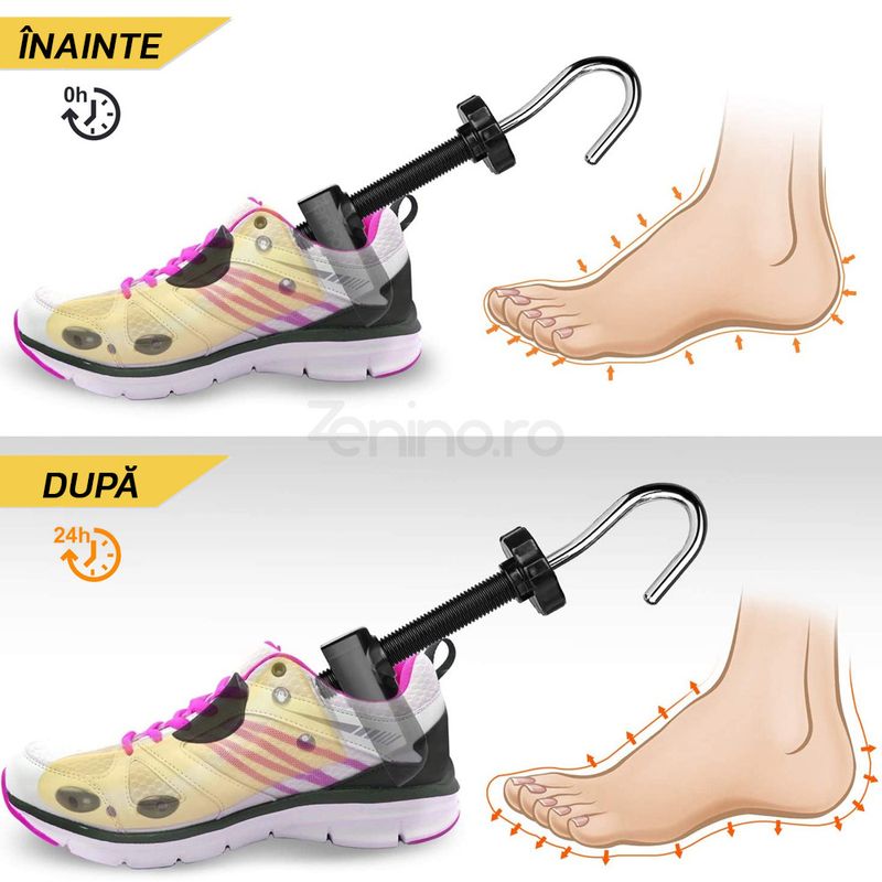 Fashion, accesorii si bijuterii - Femei - Incaltaminte femei - Accesorii incaltaminte - Set 2 Sanuri Reglabile Zenino - Alungit si Largit Pantofi, Universal, Arc, Marime 35-42, ABS, Galben - Infinity.ro