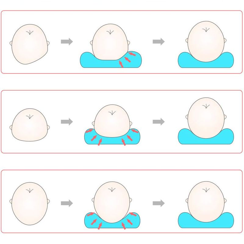 Jucarii, Copii si Bebe - Maternitate - Accesorii alaptare - Perna bebelusi cu 2 huse contra plagiocefaliei pentru formarea capului, Galben - Infinity.ro