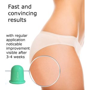 Ventuza pentru masaj corporal anticelulitic, Cellubelle, din silicon medicinal, Fara PVC si plastic, Turcoaz