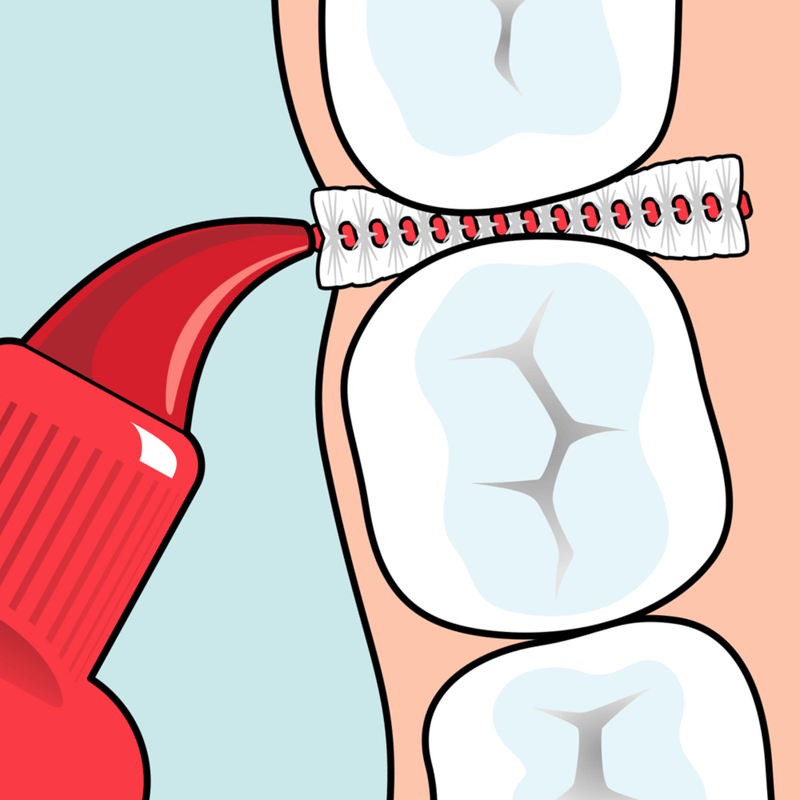 Ingrijire personala si Cosmetice - Igiena dentara - Periute de dinti clasice - Periute interdentare TePe Original, roz, 6 bucati, blister - Infinity.ro