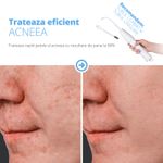 Ingrijire personala si Cosmetice - Aparate & accesorii ingrijire personala - Aparate cosmetice - Aparate intretinere si ingrijire corporala - Electroderm, LittleDomi, Tratament cu Frecventa Inalta pentru Acnee, Riduri, Controlul Petelor, Cearcane, Ten, Par - Infinity.ro