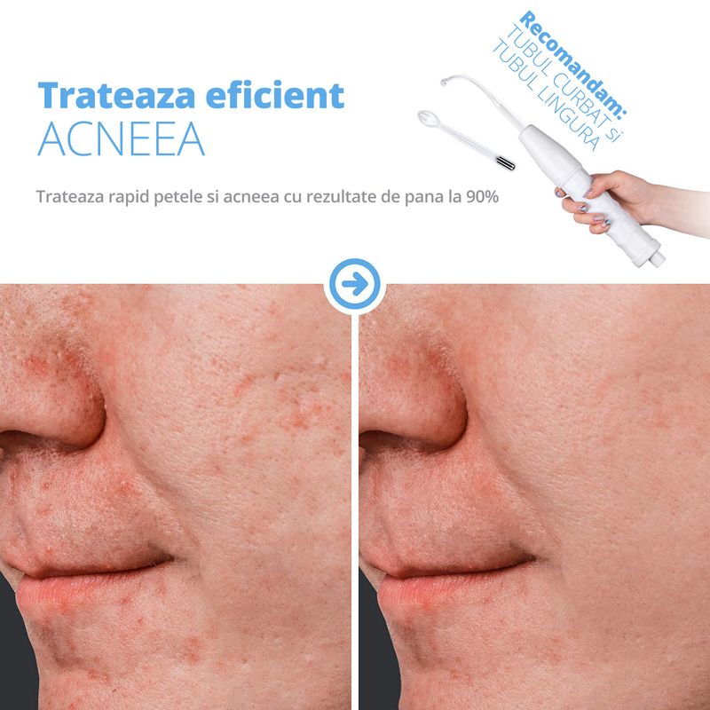 Ingrijire personala si Cosmetice - Aparate & accesorii ingrijire personala - Aparate cosmetice - Aparate intretinere si ingrijire corporala - Electroderm, LittleDomi, Tratament cu Frecventa Inalta pentru Acnee, Riduri, Controlul Petelor, Cearcane, Ten, Par - Infinity.ro