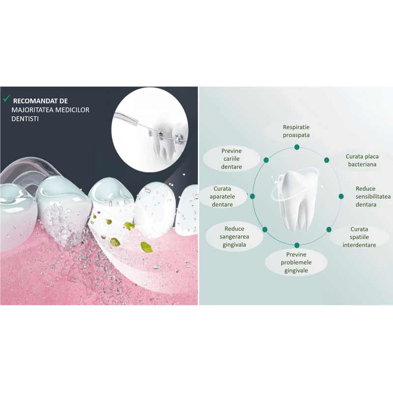 Ingrijire personala si Cosmetice - Igiena dentara - Irigatoare bucale - Irigator Oral Profesional pentru Dus Bucal, SINZO®, 5 Programe, portabil, Incarcare Type C, Ipx7, 8 Capete incluse - Infinity.ro