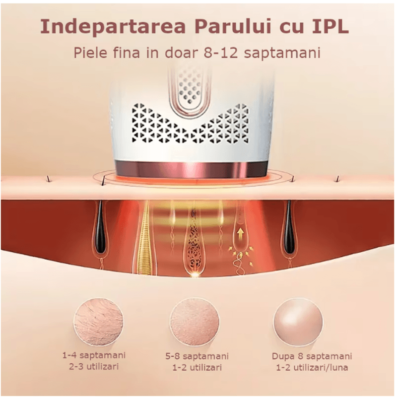 Ingrijire personala si Cosmetice - Aparate & accesorii ingrijire personala - Epilatoare si accesorii - Epilatoare - Epilator IPL SINZO®, epilare definitiva fara durere, 999.999 impulsuri, Tehnologie IPL, 5 trepte de intensitate - Infinity.ro