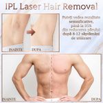 Ingrijire personala si Cosmetice - Aparate & accesorii ingrijire personala - Epilatoare si accesorii - Epilatoare - Epilator IPL SINZO®, epilare definitiva fara durere, 999.999 impulsuri, Tehnologie IPL, 5 trepte de intensitate - Infinity.ro