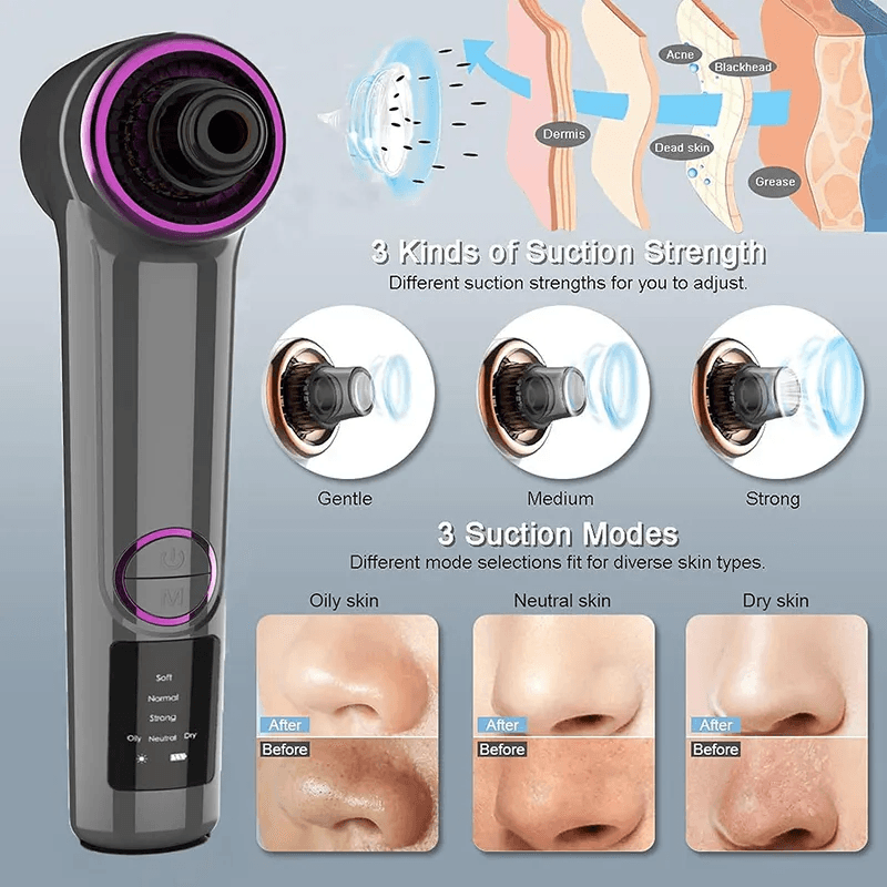 Ingrijire personala si Cosmetice - Aparate & accesorii ingrijire personala - Aparate cosmetice - Aparate intretinere si ingrijire corporala - Aparat de Indepartat Puncte Negre, cu Vacuum SINZO®, 3 programe de aspirare, incarcare USB, Negru - Infinity.ro