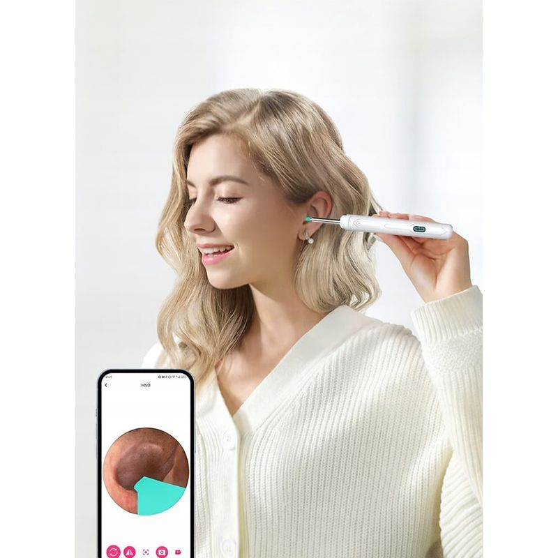Ingrijire personala si Cosmetice - Sanatate si wellness - Aparate medicale - Dispozitive si accesorii medicale uz casnic - Dispozitiv curatare urechi, Otoscop, NewEvo®, Camera FullHD, 1080P, 6 lumini LED, Incarcare USB-C - Infinity.ro