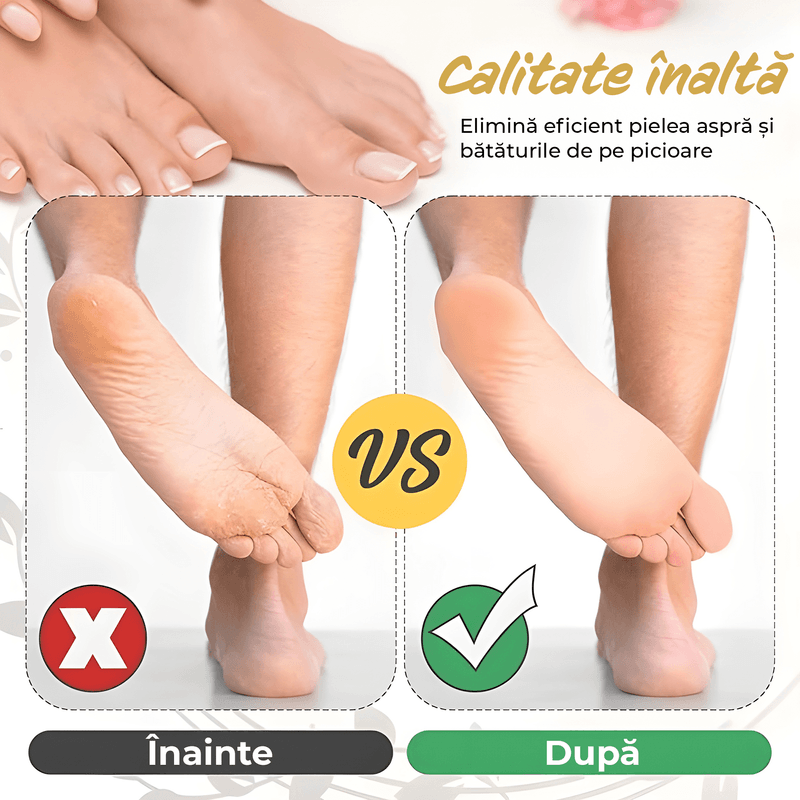 Ingrijire personala si Cosmetice - Aparate & accesorii ingrijire personala - Aparate cosmetice - Aparate pentru manichiura-pedichiura - Set accesorii pentru Pila electrica pentru talpi si calcaie IMA Trend, 3 role, Indepartare piele moarta - Infinity.ro