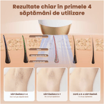 Ingrijire personala si Cosmetice - Aparate & accesorii ingrijire personala - Epilatoare si accesorii - Epilatoare - Epilator IPL N2L Store®, 999.900 Impulsuri, 9 Nivele de Intensitate, pentru Fata si Corp - Infinity.ro