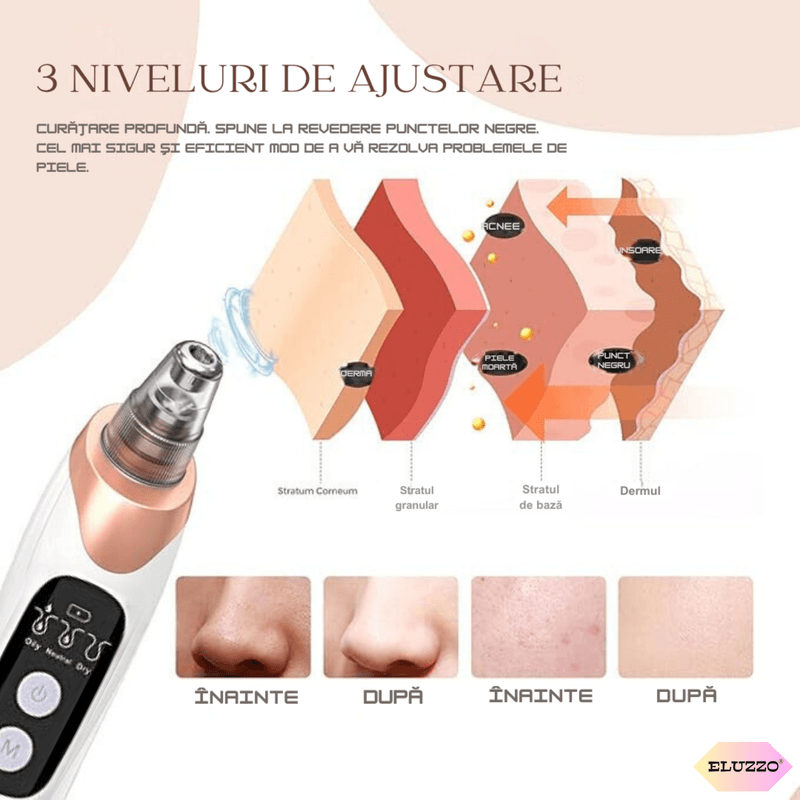 Ingrijire personala si Cosmetice - Aparate & accesorii ingrijire personala - Aparate cosmetice - Aparate intretinere si ingrijire corporala - Aparat Indepartat Puncte Negre si de Grasime ELUZZO®, Vacuum, Ingrijire Faciala, Curatare Ten, Pori si Acnee - Infinity.ro