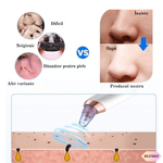 Ingrijire personala si Cosmetice - Aparate & accesorii ingrijire personala - Aparate cosmetice - Aparate intretinere si ingrijire corporala - Aparat Indepartat Puncte Negre si de Grasime ELUZZO®, Vacuum, Ingrijire Faciala, Curatare Ten, Pori si Acnee - Infinity.ro