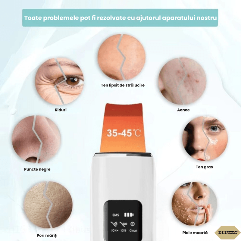 Ingrijire personala si Cosmetice - Aparate & accesorii ingrijire personala - Aparate cosmetice - Aparate intretinere si ingrijire corporala - Aparat de Curatare Faciala cu Ultrasunete ELUZZO®, Masaj, Scrubber pentru Ten, Indepartare Puncte Negre - Infinity.ro