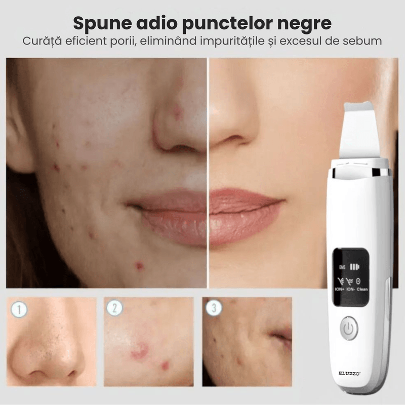 Ingrijire personala si Cosmetice - Aparate & accesorii ingrijire personala - Aparate cosmetice - Aparate intretinere si ingrijire corporala - Aparat de Curatare Faciala cu Ultrasunete ELUZZO®, Masaj, Scrubber pentru Ten, Indepartare Puncte Negre - Infinity.ro