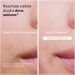 Ingrijire personala si Cosmetice - Aparate & accesorii ingrijire personala - Epilatoare si accesorii - Epilatoare - Epilator IPL Braun Silk-expert PRO 5 PL5382 Senzor automat & continuu Skin pro 2.0, 400.000 impulsuri, 10 intensitati - Infinity.ro