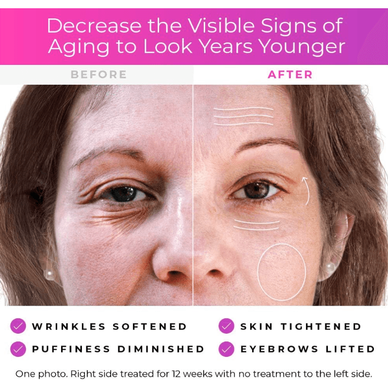 Ingrijire personala si Cosmetice - Sanatate si wellness - Articole wellness - Aparate si dispozitive de masaj - Derma Wand aparat de masaj anti imbatranire pentru fata - Infinity.ro