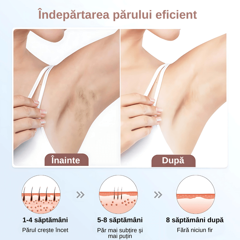 Ingrijire personala si Cosmetice - Aparate & accesorii ingrijire personala - Epilatoare si accesorii - Epilatoare - Epilator IPL multifunctional, epilare definitiva, 300.000 impulsuri, mod manual/automat, ecran digital, unisex, alb - Infinity.ro
