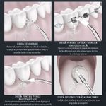 Ingrijire personala si Cosmetice - Igiena dentara - Irigatoare bucale - Irigator Bucal Profesional, Adsinio, 4 Capete,5 Trepte de Presiune, Rezervor Detasabil 300ml, Negru - Infinity.ro