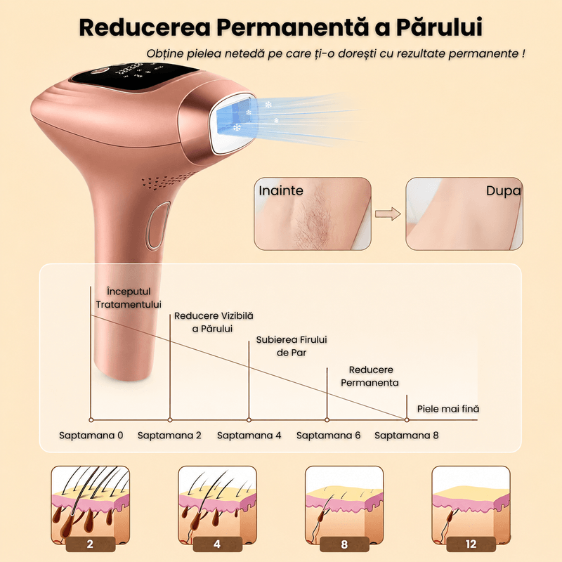 Ingrijire personala si Cosmetice - Aparate si accesorii ingrijire personala - Epilatoare si accesorii - Epilatoare - Epilator IPL, 9 Niveluri de Energie, Moduri HR/SC/RA, Capete Magnetice, Tehnologie de Racire, 999.999 Impulsuri - Infinity.ro